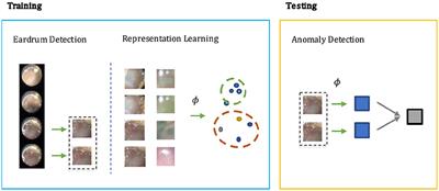 Pediatric Otoscopy Video Screening With Shift Contrastive Anomaly Detection